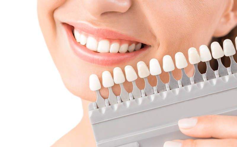 Особенности и преимущества наращивания зубов