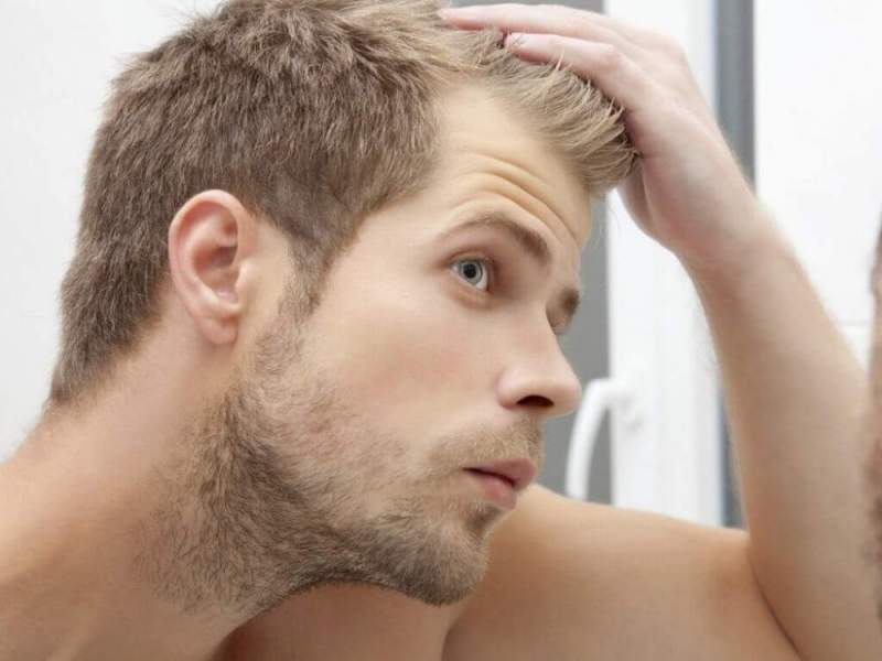 Популярные методы пересадки волос и показания к их проведению