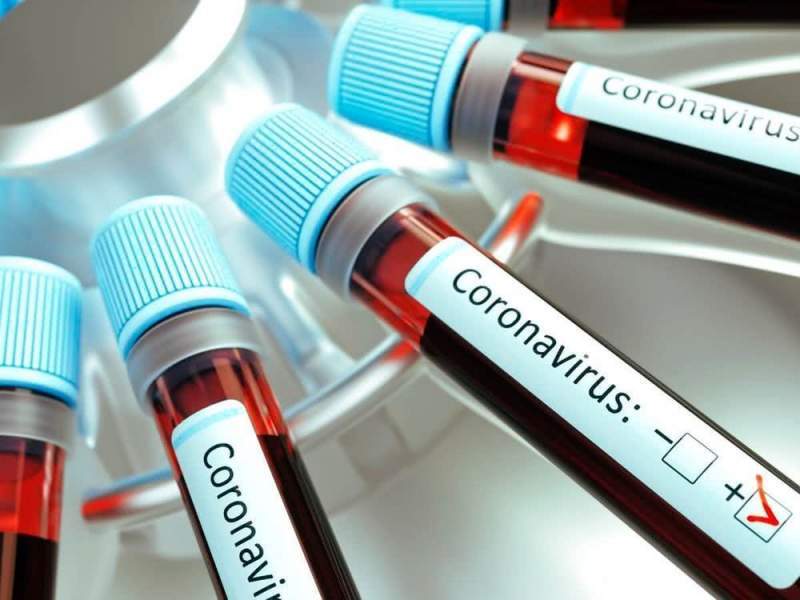 Специалист назвал сдачу тестов на антитела к коронавирусу бессмысленными