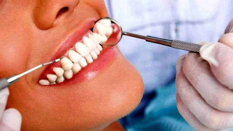 Плюсы протезирования зубов