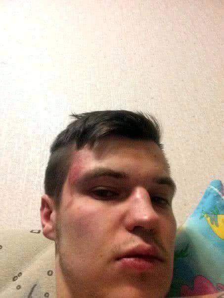 В Ставрополе избили местного оппозиционера-активиста