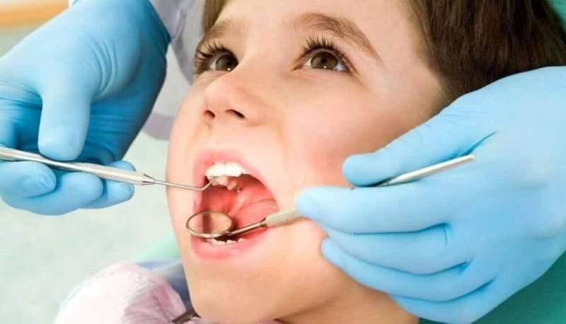 Лечение зубов у детей в стоматологии в Сочи