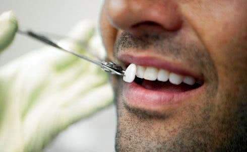 Художественная реставрация зубов – быстрое и безболезненное устранение дефекта