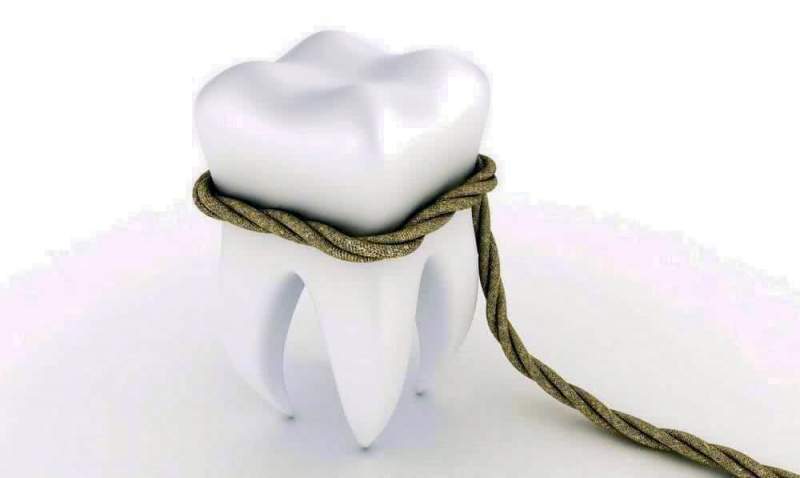 Наиболее распространенные показания для удаления зуба