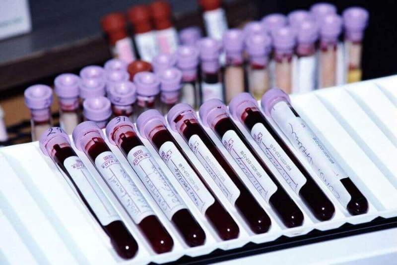 Ученые близки к созданию безграничных запасов донорской крови