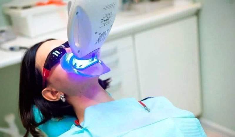 Лучшая технология отбеливания зубов
