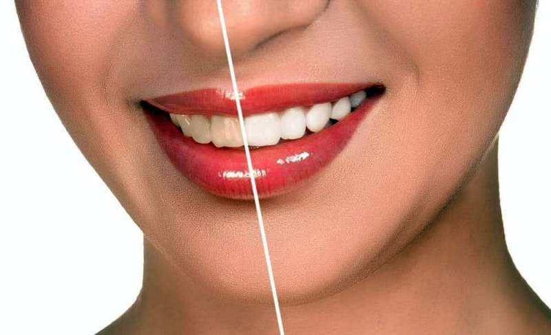 Современные методики реставрации зубов
