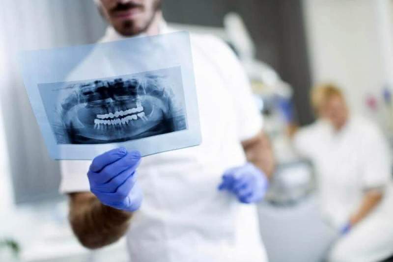 Установка имплантов в немецких стоматологических клиниках 