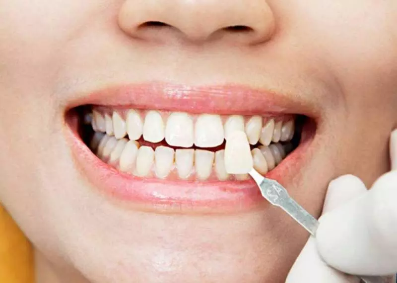 Безупречная улыбка благодаря стоматологическим 3D-принтерам