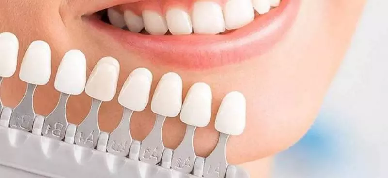 Особенности эстетической реставрации зубов